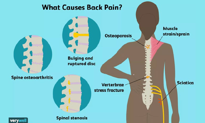 HANYAO-medical-for-Back-pain