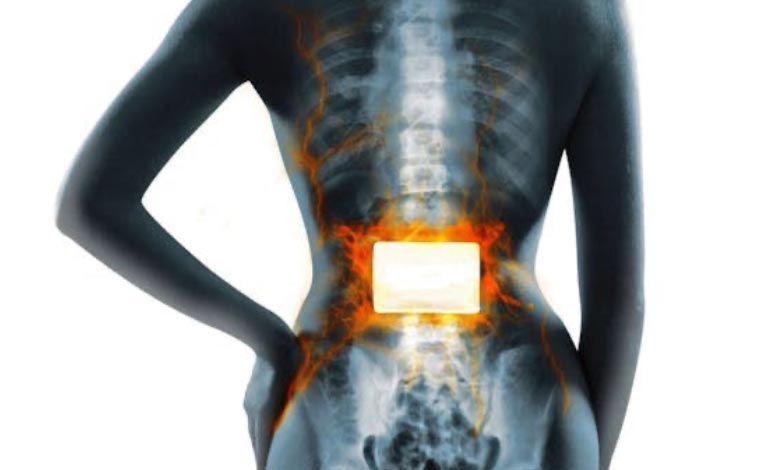 help-back-pain