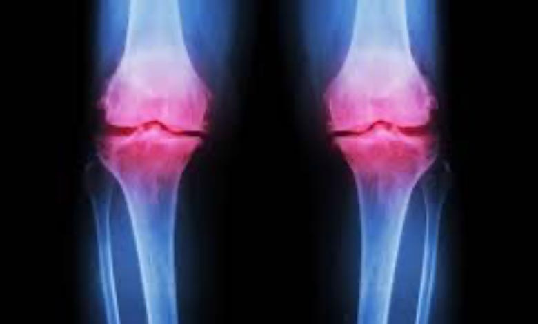 Different-types-of-pain