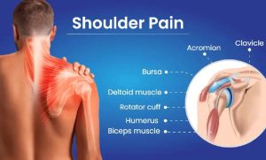 Hanyao’s-Pain-Relief-Patch-Really-Work